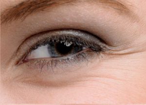 Lee más sobre el artículo Gel anti arrugas contorno de ojos