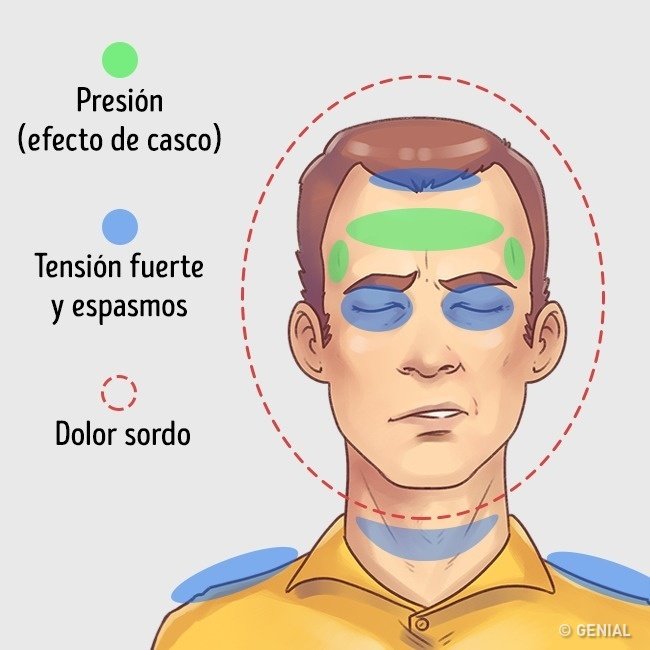 En este momento estás viendo 5 Tipos de dolor de cabeza y cómo aliviarlos rápidamente