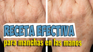 Lee más sobre el artículo Receta efectiva para Eliminar las Manchas en las manos