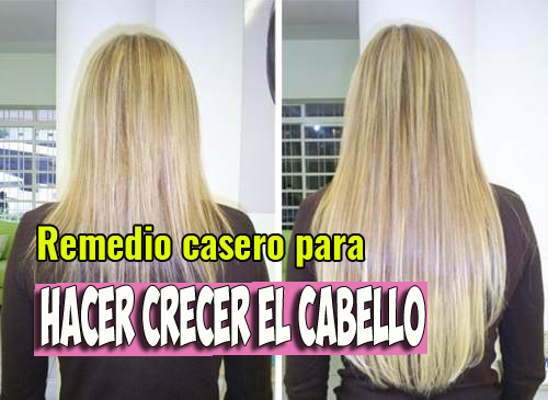 En este momento estás viendo Increíble remedio para evitar la caída y hacer crecer el cabello